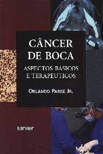 Câncer De Boca: Aspectos Básicos E Terapêuticos
