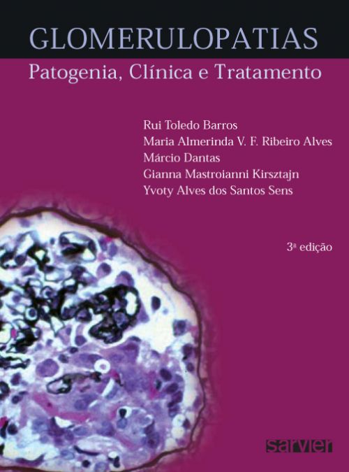 Glomerulopatias: Patogenia, Clinica E Tratamento